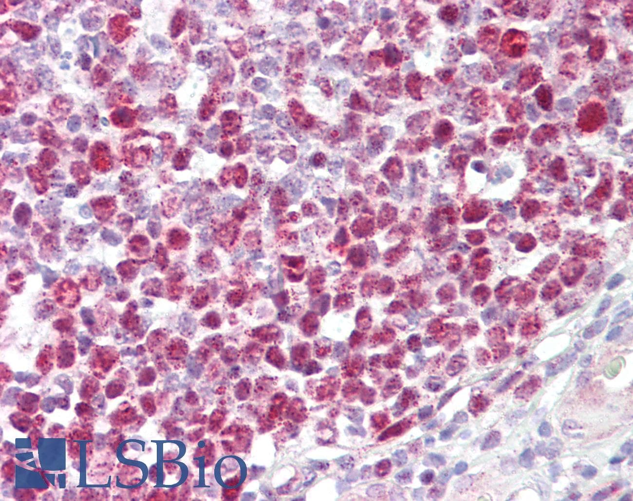 IHC-plus™ Polyclonal Rabbit anti-Human RB1 / Retinoblastoma / RB Antibody (aa781-830, IHC, WB)