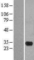 HMX2 Protein (Over-Expression Lysate Myc-DDK (Flag))
