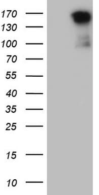 c-Met Antibody (aa125-421, clone OTI18A5)