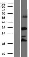 RRNAD1 / C1orf66 Protein (Over-Expression Lysate Myc-DDK (Flag))
