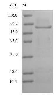Human MAG Protein (Recombinant 6His, N-terminus)