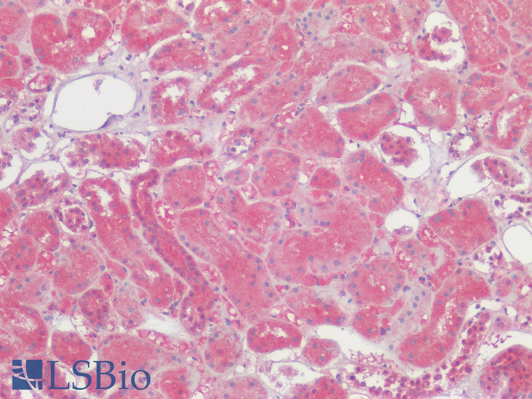 IHC-plus™ Polyclonal Rabbit anti-Human SLC29A1 / ENT1 Antibody (Internal, IHC)