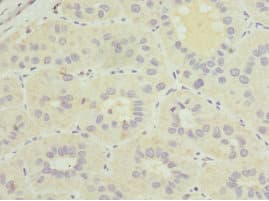 GDAP1 Antibody