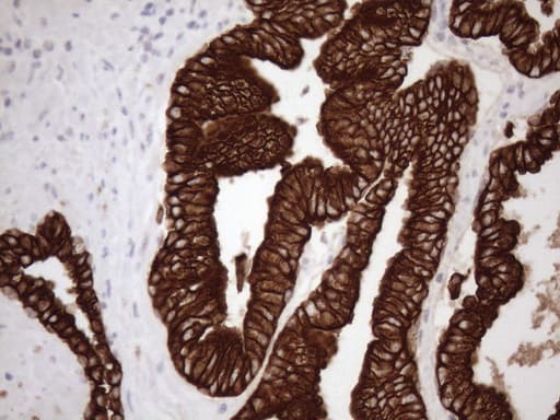 KRT18 / CK18 / Cytokeratin 18 Antibody (aa69-372, clone OTI3D1)