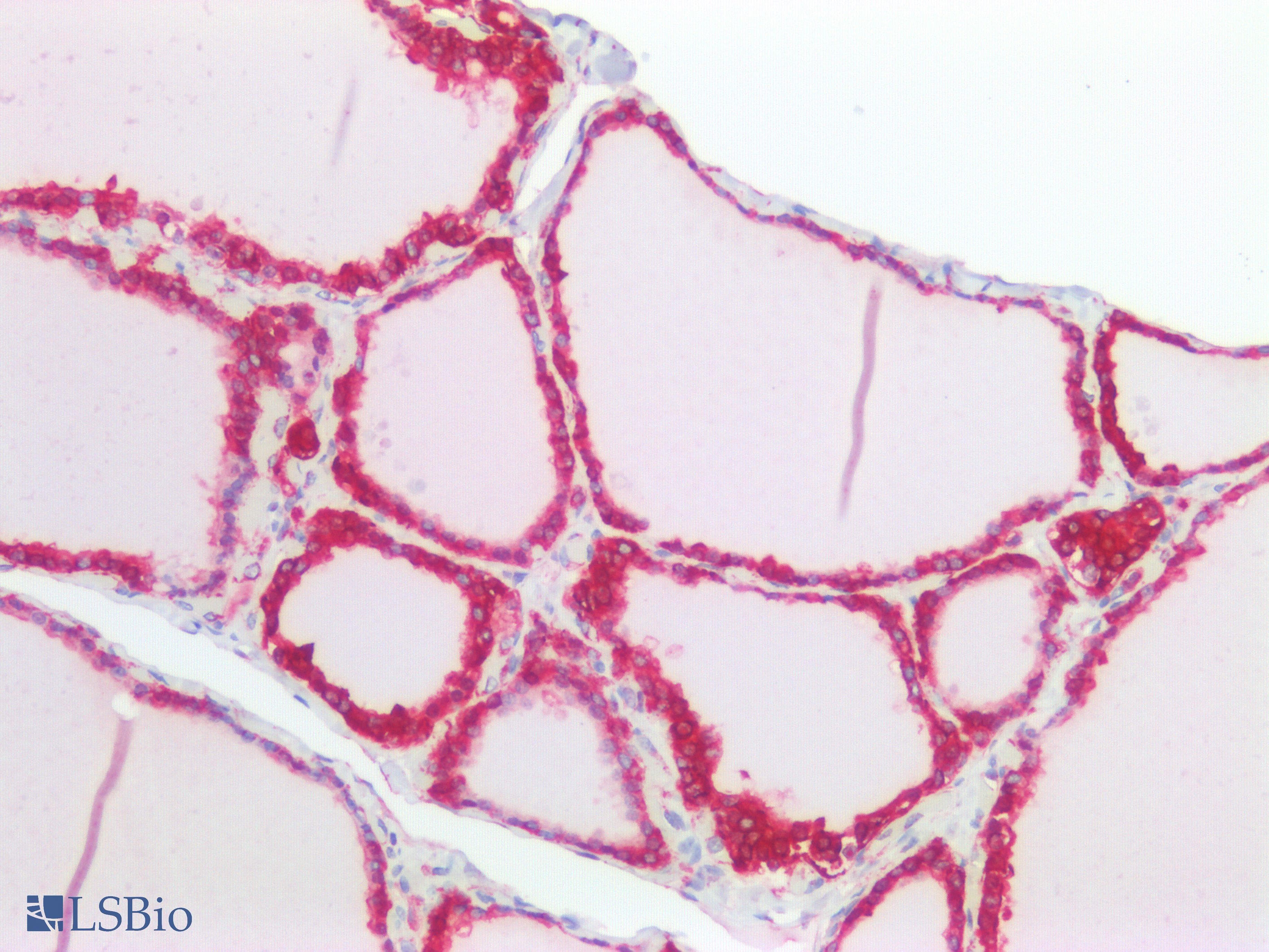 IHC-plus™ KRT18 / CK18 / Cytokeratin 18 Antibody (C-Terminus)