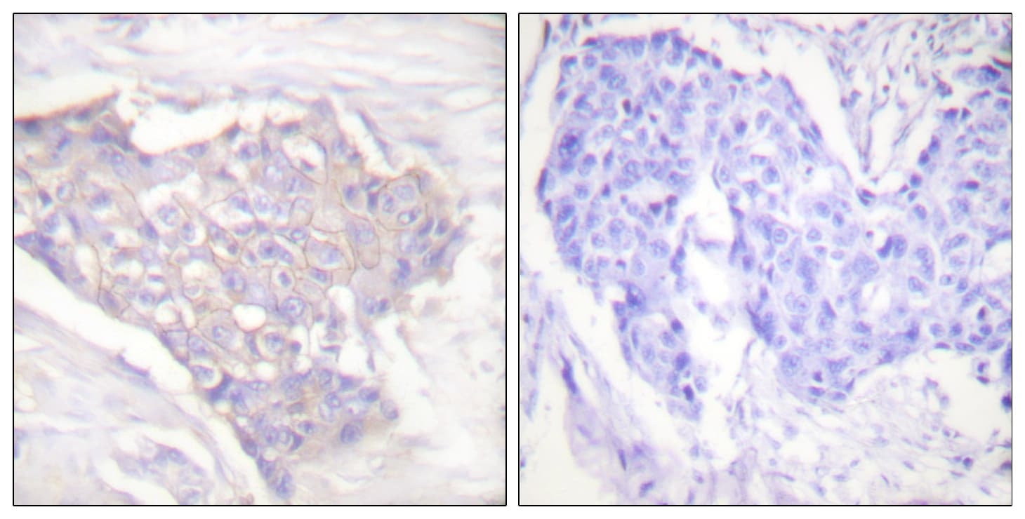BCL2L11 / BIM Antibody (aa1-50)