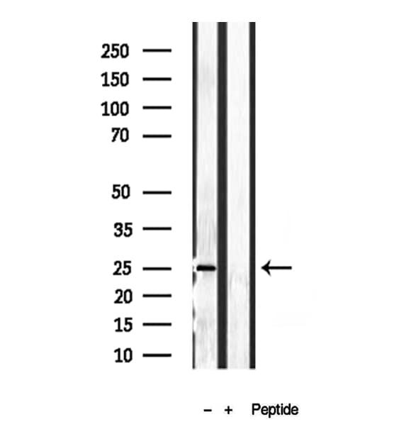 PLDN / Pallidin Antibody