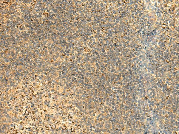 Polyclonal Rabbit anti-Human ATP5H Antibody (IHC, WB)