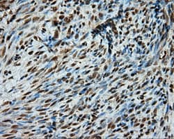 Monoclonal Mouse anti-Human PSMC3 Antibody (clone OTI1C10, IHC, IF, WB)