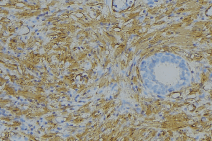 APOL5 / Apolipoprotein L 5 Antibody