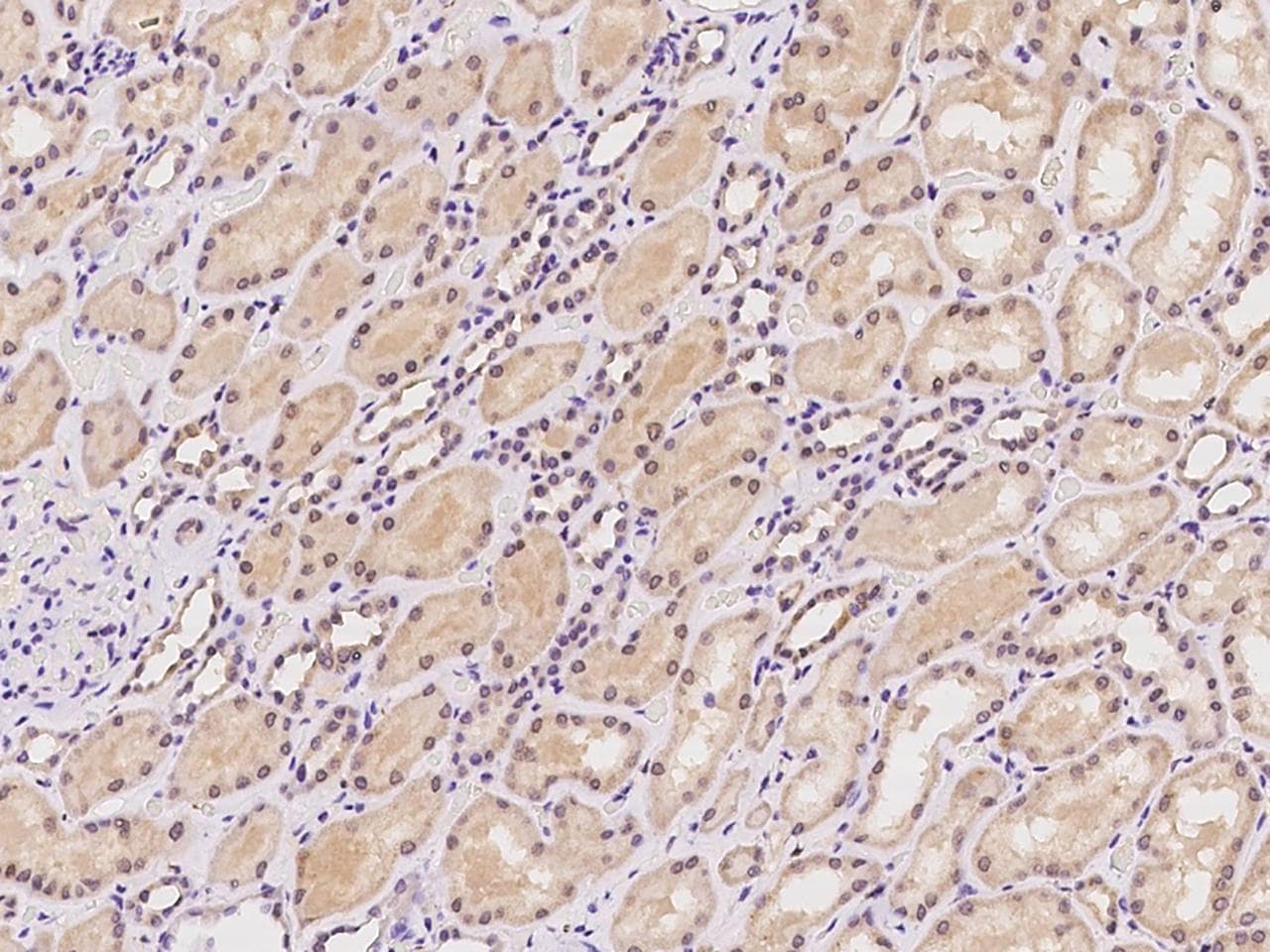 GPX1 / Glutathione Peroxidase Antibody