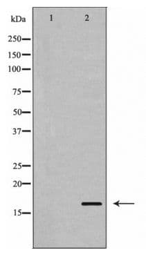 STMN1 / Stathmin / LAG Antibody