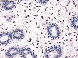 BRAF / B-Raf Antibody (clone OTI3A7)