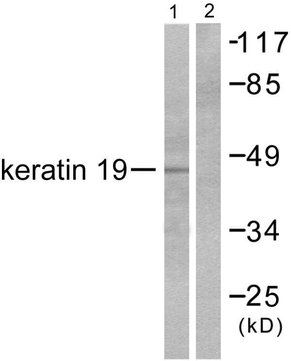 KRT19 / CK19 / Cytokeratin 19 Antibody