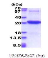 Human ICAM2 / CD102 Protein (Recombinant His)