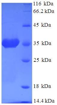 Human ARF6 Protein (Recombinant His-SUMO)
