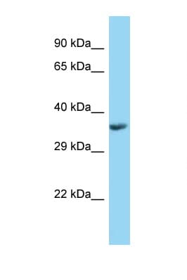 PPT1 / CLN1 Antibody (C-Terminus)