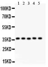 KLF6 Antibody (aa38-205)