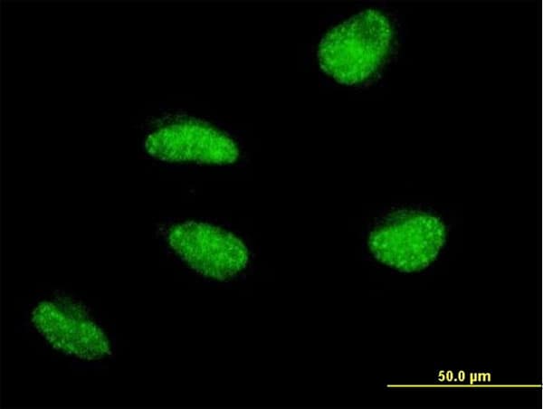 Monoclonal Mouse anti-Human MSH5 Antibody (clone 1C11, IF, WB)