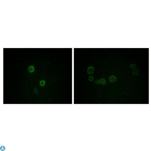APOM / Apolipoprotein M Antibody
