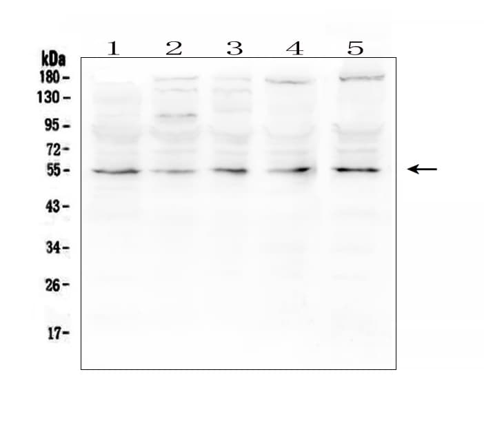 MMP13 Antibody