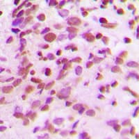 Polyclonal Rabbit anti-Human RTCD1 / RPC Antibody (C-Terminus, IHC, WB)