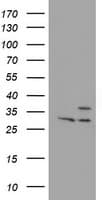 PSMB7 Antibody (aa58-277, clone OTI1B2)