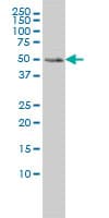 Monoclonal Mouse anti-Human MEIS2 Antibody (clone 1H4, IHC, IF, WB)
