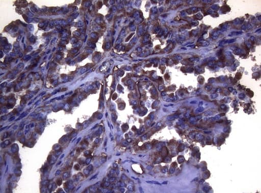 S100A9 / MRP14 Antibody (clone OTI3F8)