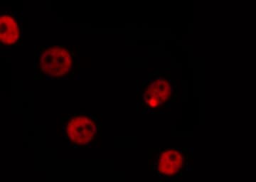 MDM2 Antibody