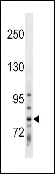 TBCK / TBCKL Antibody (aa109-135)
