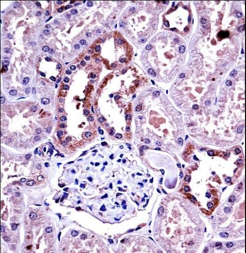 CSF1 / MCSF Antibody (aa230-257)