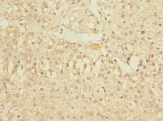 Polyclonal Rabbit anti-Human ZNF791 Antibody