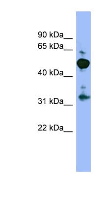 Polyclonal Rabbit anti-Human MPP2 Antibody (aa359-408, WB)