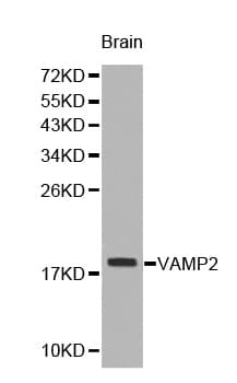 Polyclonal Rabbit anti-Human VAMP2 / VAMP-2 Antibody (IHC, WB)