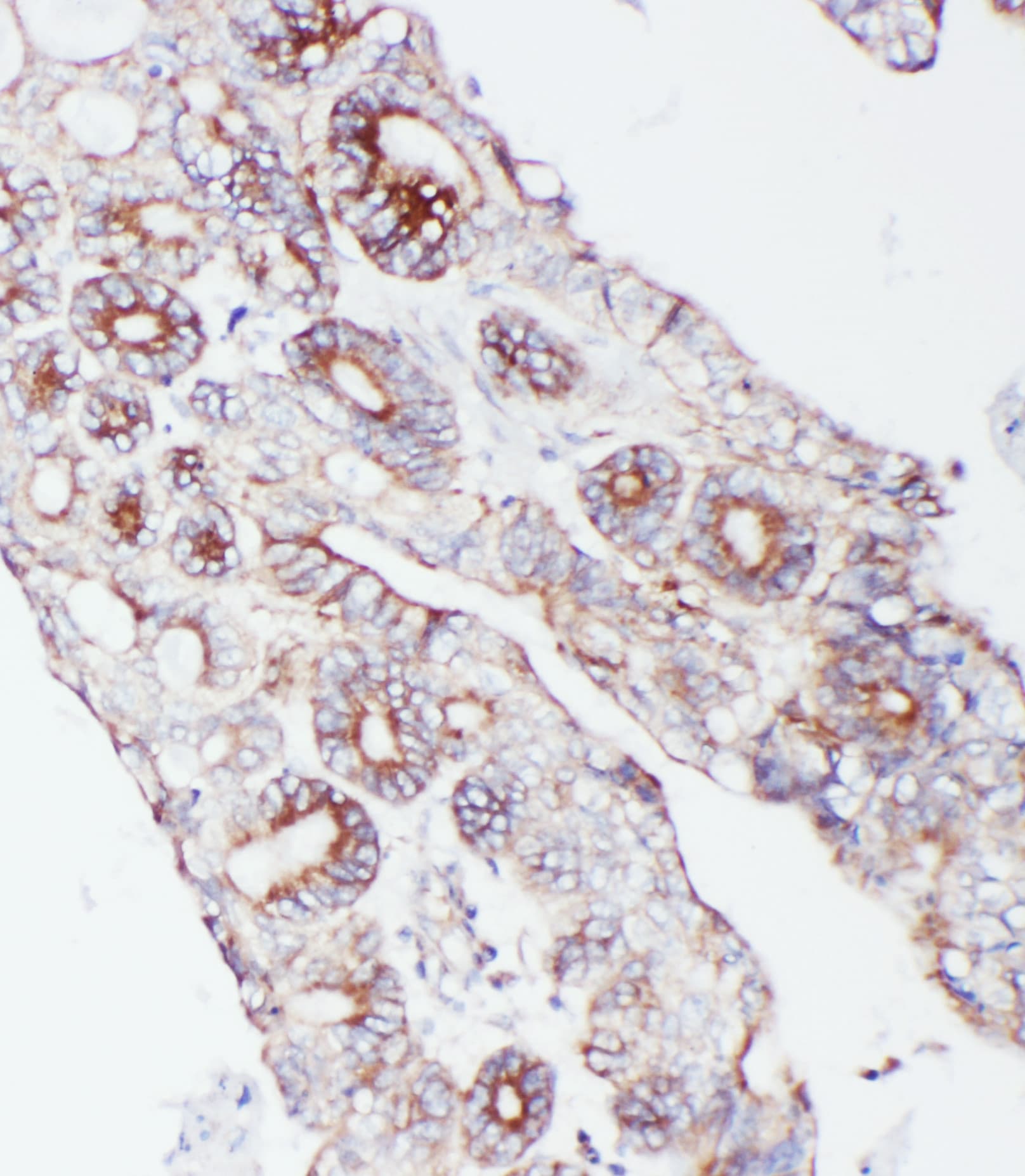 PCSK9 Antibody (aa671-687)