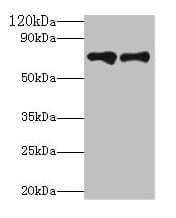 KLKB1 / Plasma Kallikrein Antibody