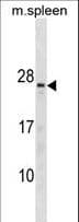 Polyclonal Rabbit anti-Human TNNC2 Antibody (aa97-126, WB)