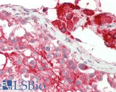 Polyclonal Rabbit anti-Rat LRP2BP / LRP2 Binding Protein Antibody (aa201-250, IHC, WB)