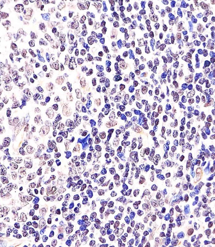 BCL6 Antibody (aa364-395)