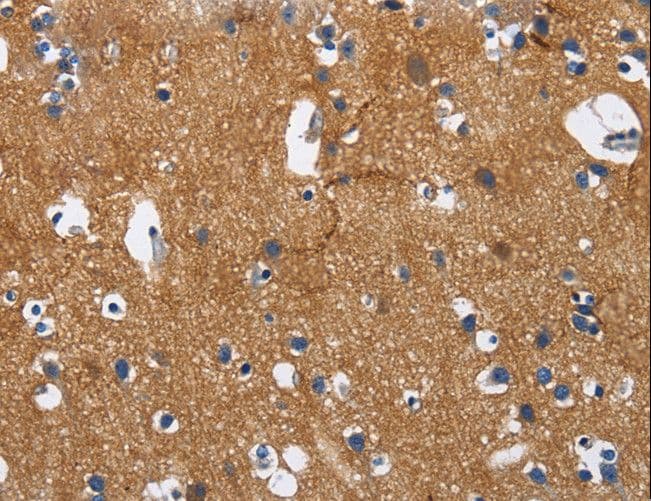 Polyclonal Rabbit anti-Human NECL-1 / CADM3 Antibody (IHC)