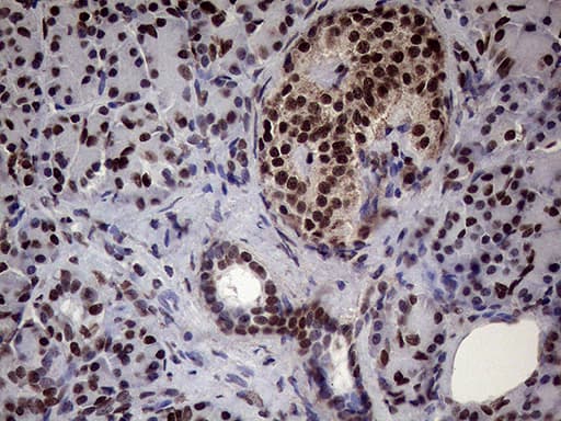 XRN2 Antibody (aa677-779, clone OTI5F4)