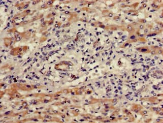 WDR19 Antibody