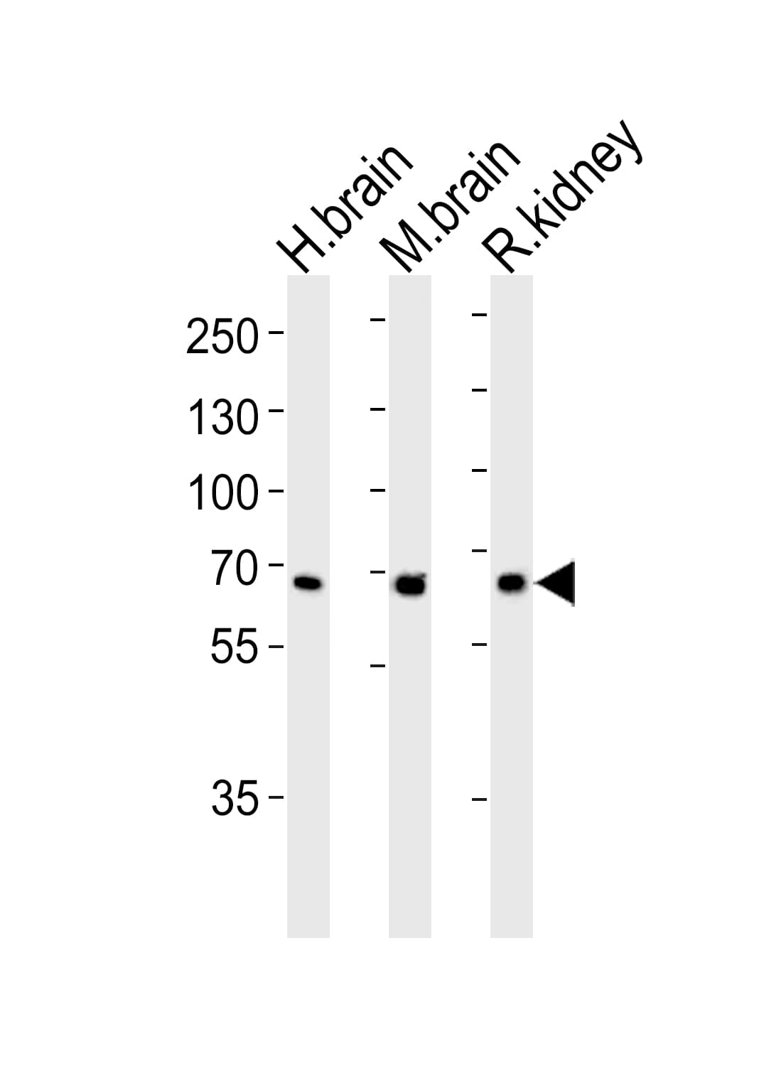 GLS / Glutaminase Antibody (aa516-545)