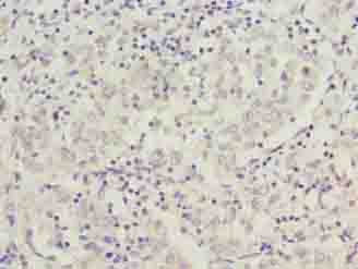 Polyclonal Rabbit anti-Human C9orf64 Antibody (IHC, WB)