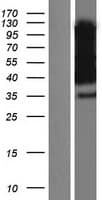 NPTN / SDR1 Protein (Over-Expression Lysate Myc-DDK (Flag))