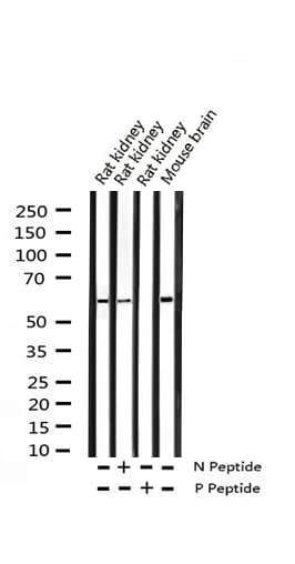 MEF2A / MEF2 Antibody (phospho-Thr312)