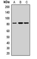 Polyclonal Rabbit anti-Human BBS10 Antibody (WB)