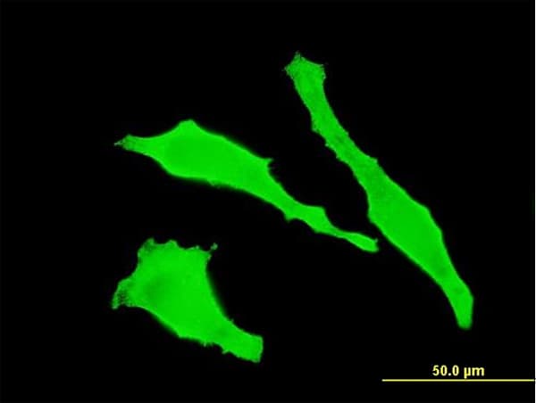 Monoclonal Mouse anti-Human TGN46 / TGN38 Antibody (clone 2F11, IHC, IF, WB)