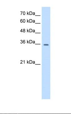 TRPM5 Antibody (aa205-254)